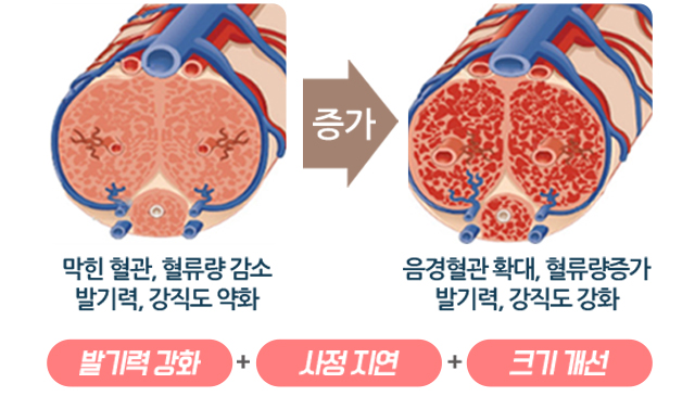 발기력 강화 사정 지연 크기 개선