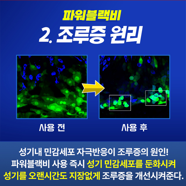 조루증 원리